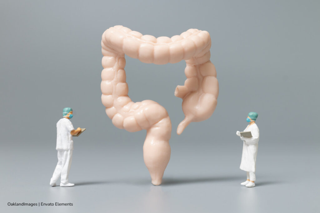 mejorar la microbiota intestinal, evitar malos hábitos para no lastimar la salud intestinal, Más Estilo de Vida